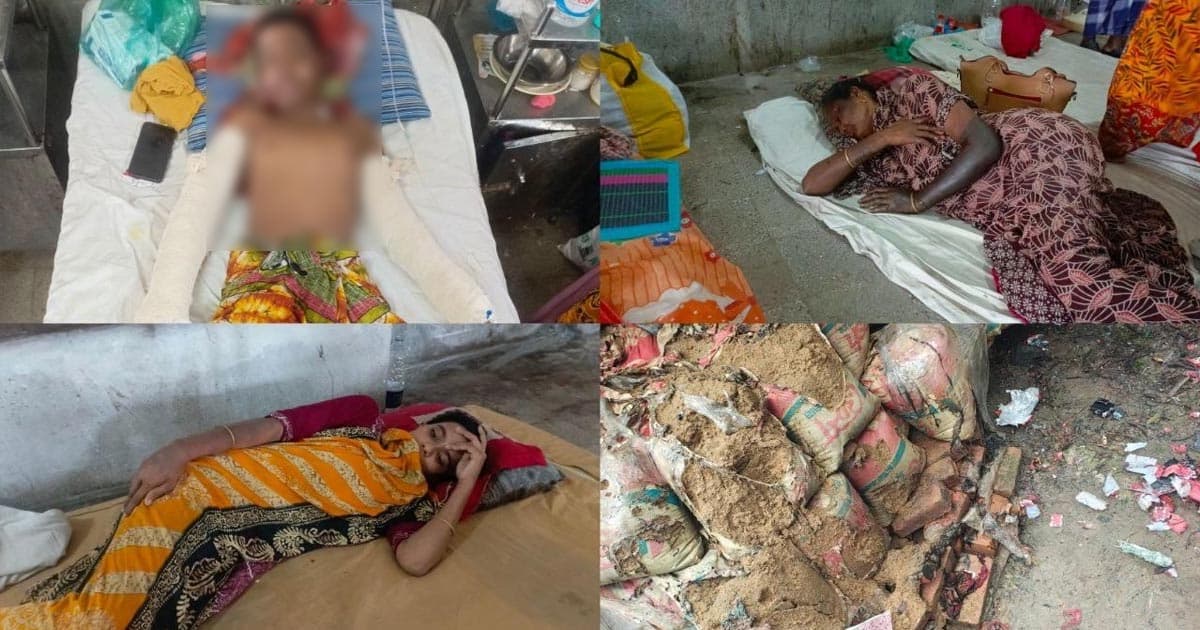 শিশুসহ দগ্ধ ৩ জন ঢাকায় স্থানান্তরিত