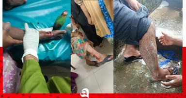 শরীয়তপুরে কুকুরের কামড়ে নারী-শিশুসহ আহত ১০