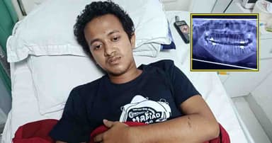 ভিডিও করায় ছাত্রদলের হামলা: জবি শিক্ষার্থীর ভাঙল চোয়াল