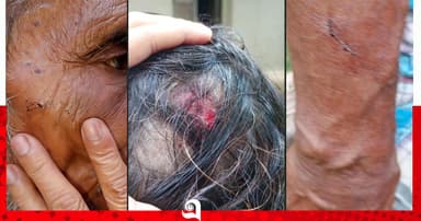 কালীগঞ্জে হামলার ঘটনার তিন দিন পর প্রবাসী পরিবারের থানায় অভিযোগ