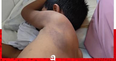 মাদ্রাসা শিক্ষকের মারধরে শিক্ষার্থী হাসপাতালে, থানায় অভিযোগ