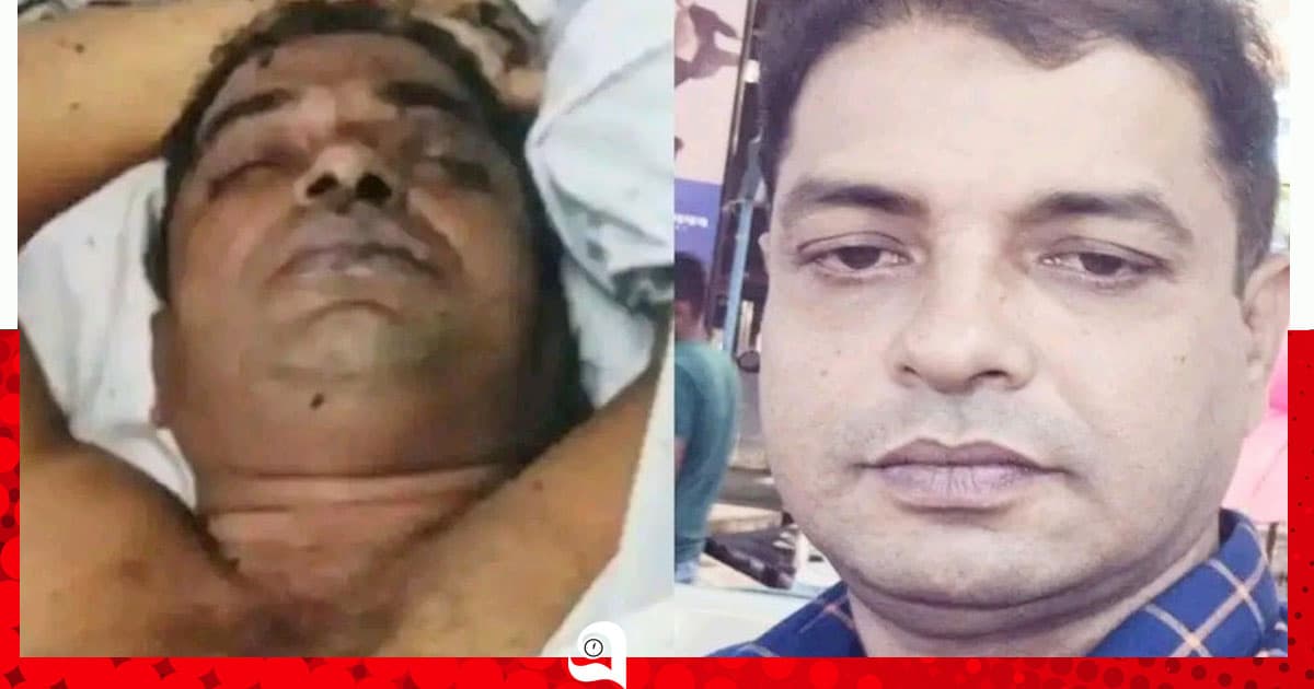 কলকাতার হোটেলে আগুনে প্রাণ গেল সাতক্ষীরার সাজুর