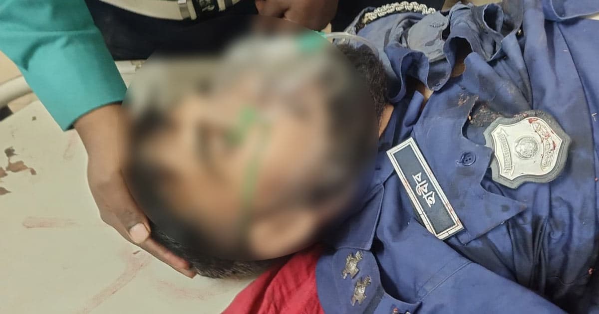 ট্রেনে কাটা পড়ে পুলিশ কর্মকর্তার হাত-পা বিচ্ছিন্ন