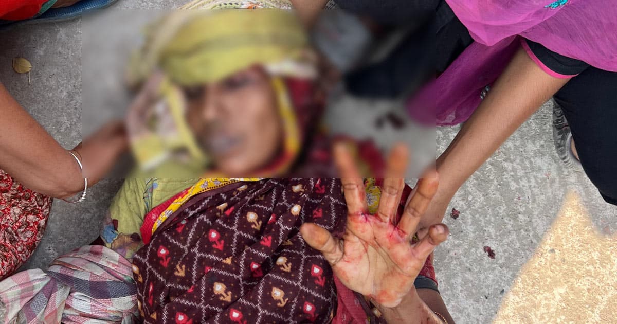 চলাচলের রাস্তা নিয়ে বিরোধ হামলায় নারীসহ জখম ৫