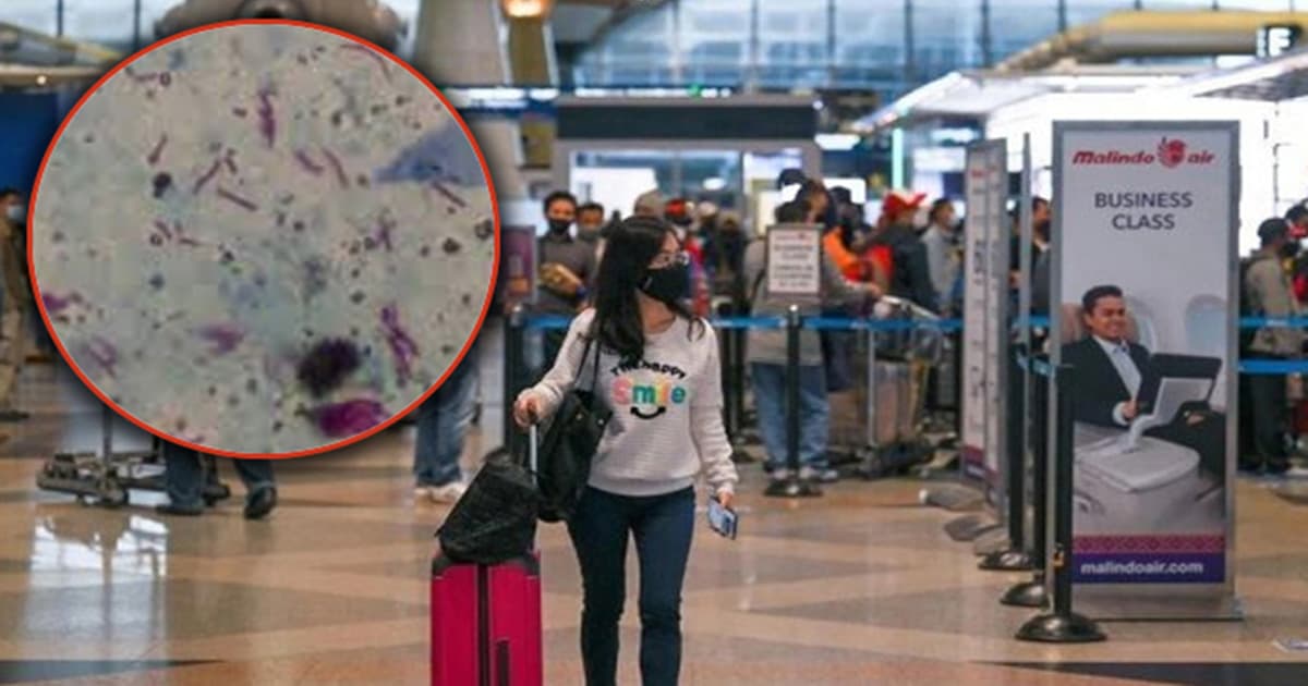 মালয়েশিয়ায় দ্রুত বাড়ছে যক্ষ্মা সংক্রমণ, সতর্কতা জারি