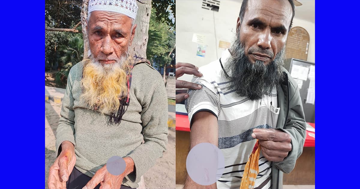 ধুনটে জমি নিয়ে বিরোধ, বাবা ও ছেলেকে কুপিয়ে জখম