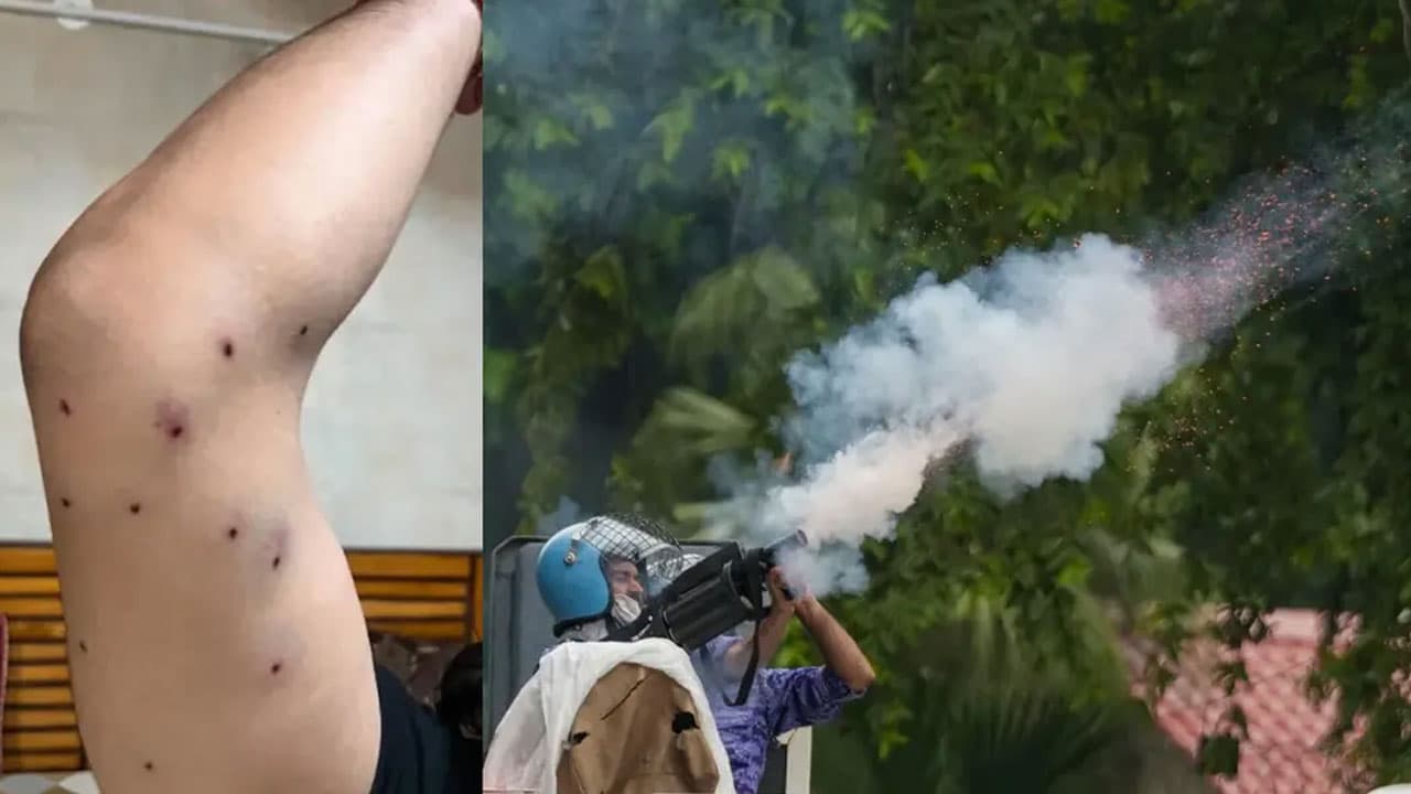 দিল্লিতে সিজেপির বিক্ষোভে ছররা গুলির অভিযোগ, অস্বীকার পুলিশের