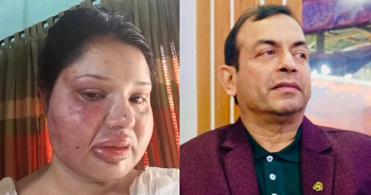 ফিজিওথেরাপির আড়ালে অবৈধ কর্মকাণ্ড, প্রতিবাদ করায় স্ত্রীকে নির্যাতন