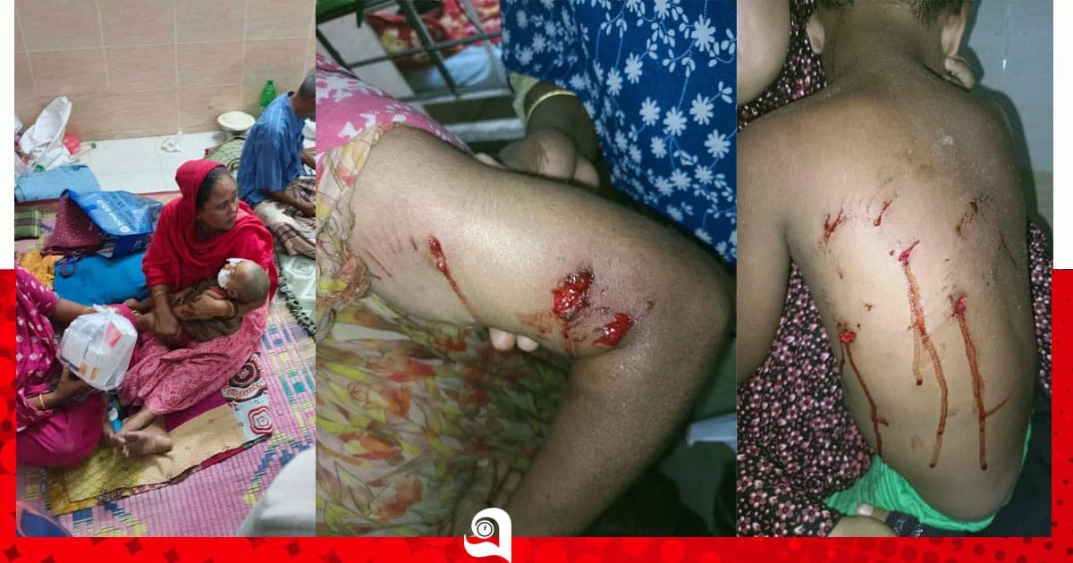পাবনায় কুকুরের কামড়ে আহত ১১