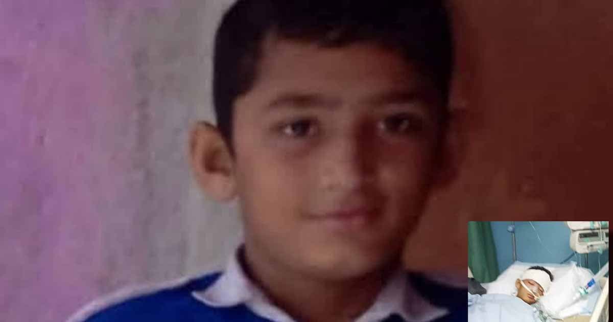 সাতকানিয়ায় মাথায় গোলপোস্ট পড়ে আহত শিক্ষার্থীর মৃত্যু