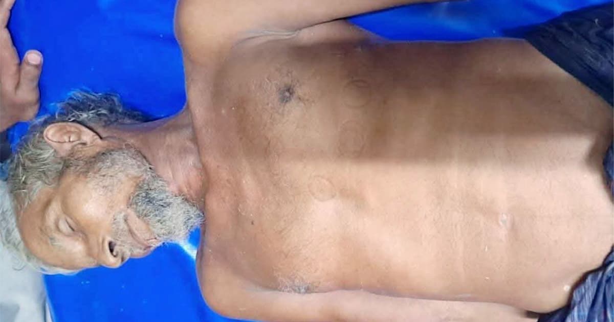কুষ্টিয়া বজ্রপাতে কৃষকের মৃত্যু, নারী ও কিশোরসহ আহত ৪