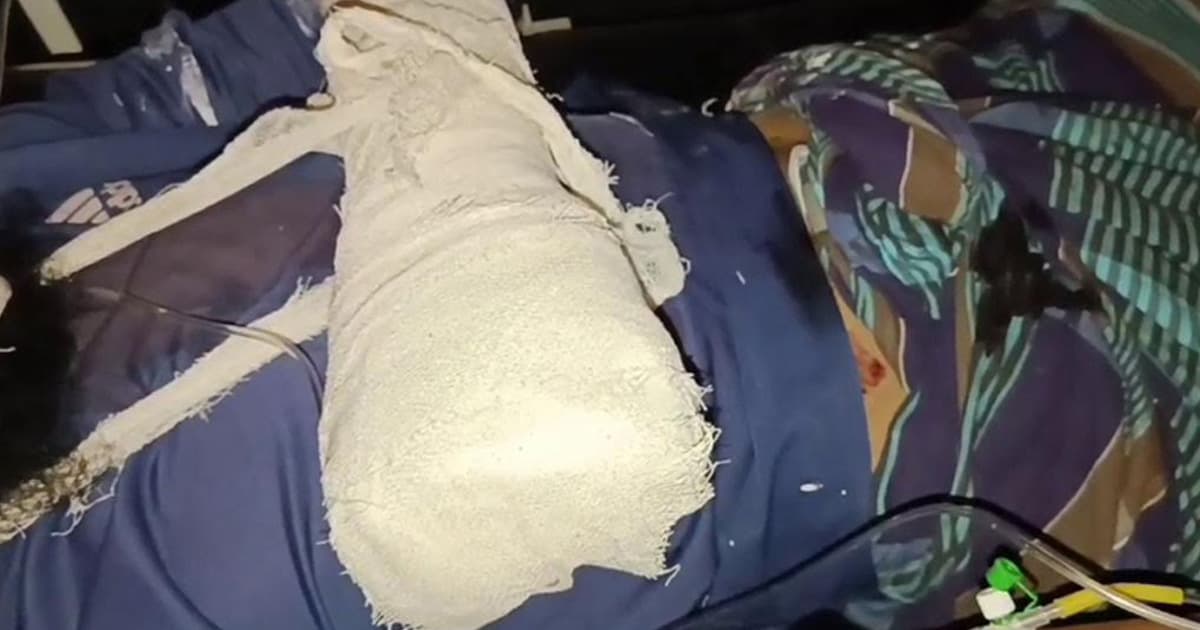 গোপালগঞ্জে হাতবোমা তৈরি করতে গিয়ে বিস্ফোরণ, যুবক আহত