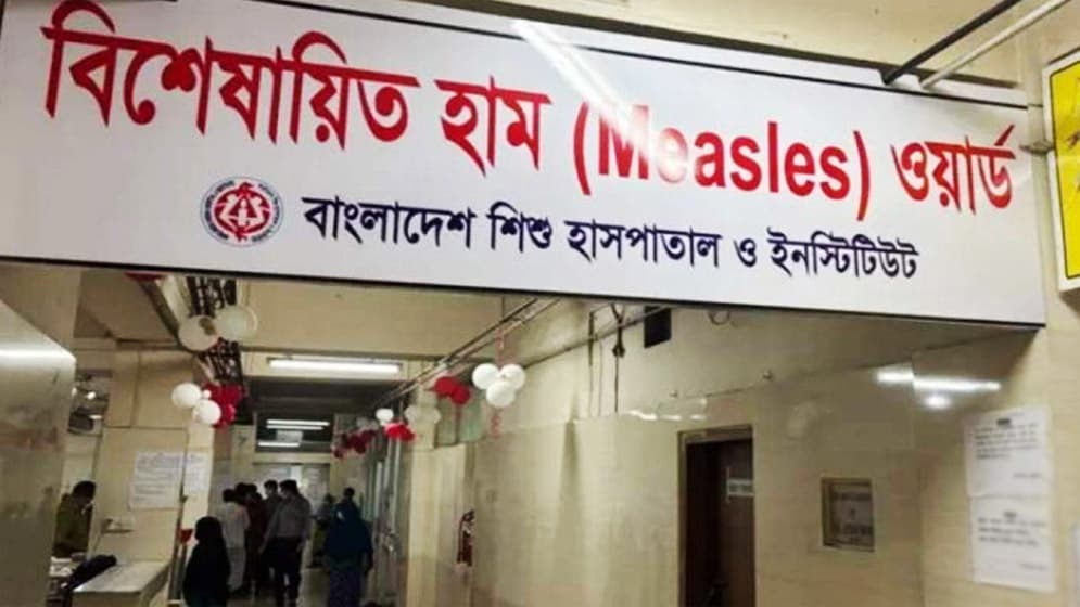 ২৪ ঘণ্টায় হামের উপসর্গ নিয়ে ৪ শিশুর মৃত্যু