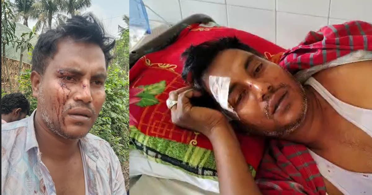 তাড়াশে জমি দখল নিয়ে সংঘর্ষে দুই ভাই আহত