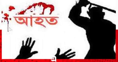 চারঘাটে ভ্যানচালককে কুপিয়ে ভ্যান ছিনতাই, গুরুতর আহত