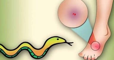 ঘুমন্ত অবস্থায় সাপের কামড়ে গৃহবধূর মৃত্যু