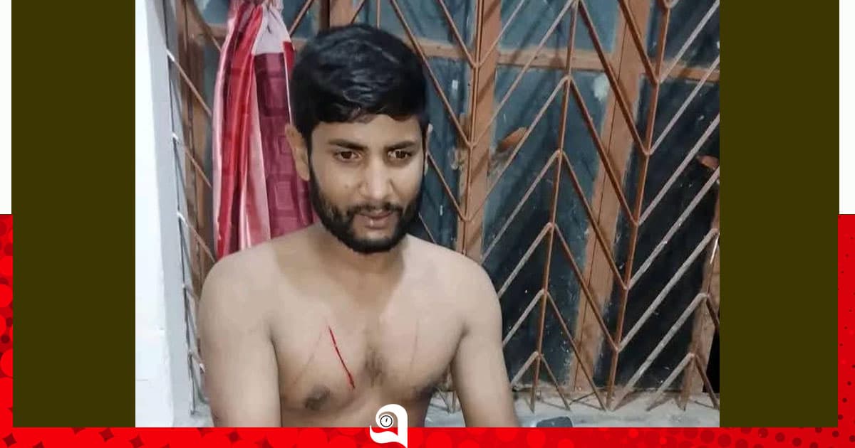 দুমকিতে গাড়িচালককে কুপিয়ে জখম
