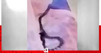রাবিতে ঘুমন্ত শিক্ষার্থীকে কালাচ সাপের কামড়