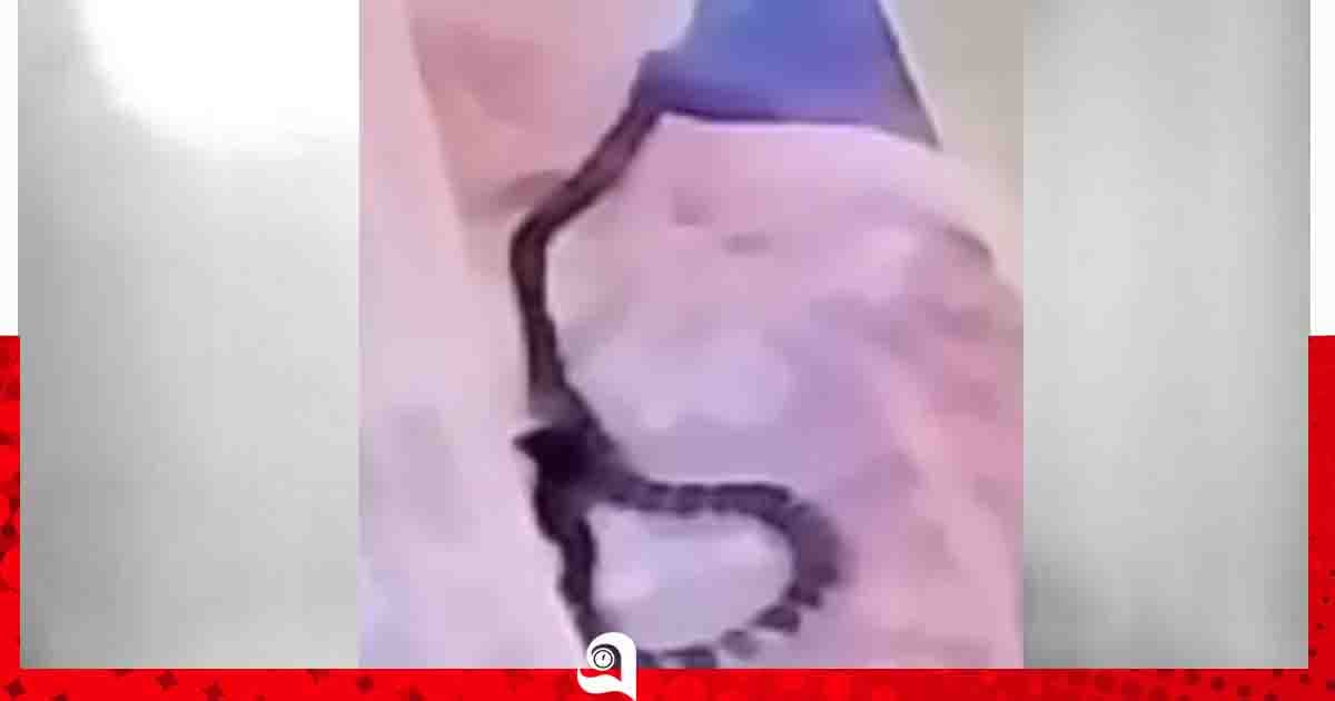রাবিতে ঘুমন্ত শিক্ষার্থীকে কালাচ সাপের কামড়