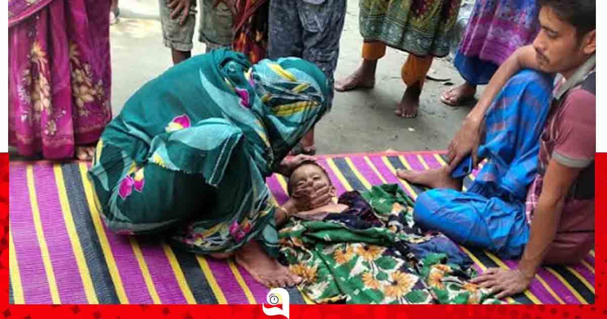 রাঙ্গাবালীতে অজ্ঞাত প্রাণীর কামড়ে শিশুর মৃত্যু