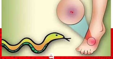 শৈলকুপায় সাপের কামড়ে শিশুর মৃত্যু