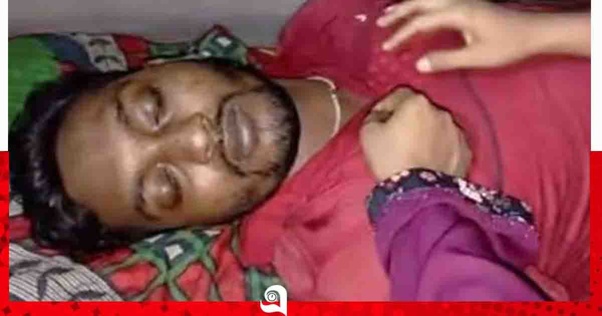 রাঙ্গাবালীতে সাপের কামড়ে যুবকের মৃত্যু