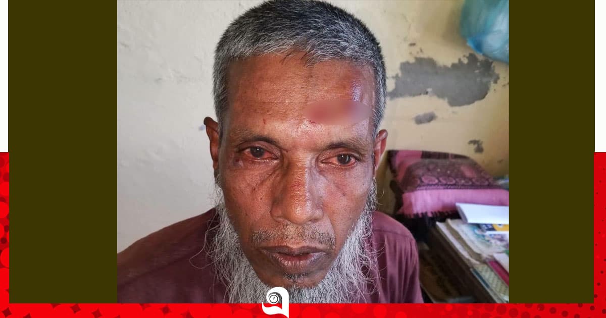 মনপুরায় মসজিদের হিসাব নিয়ে কথা বলায় শিক্ষককে মারধর