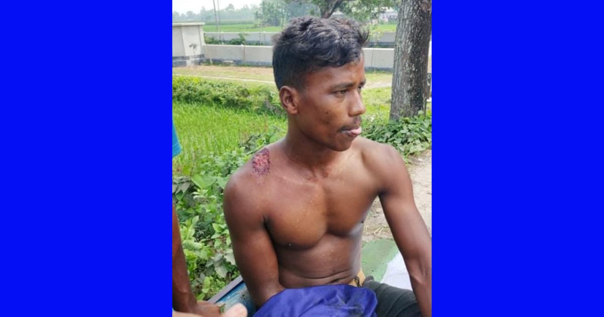 পাটগ্রামে বিএসএফের গুলিতে বাংলাদেশি যুবক আহত