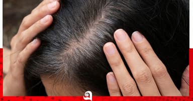 অল্প বয়সেই কেন চুল পেকে যায়?