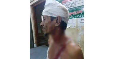 বন প্রহরীকে কুপিয়ে জখম