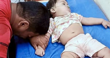 গলায় লিচুর বিচি আটকে ১০ মাস বয়সী শিশুর মৃত্যু