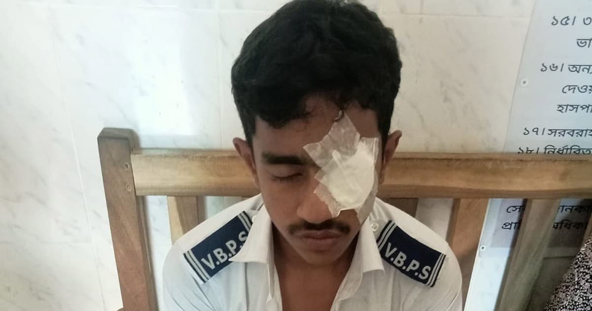উত্তরপত্র দেখতে না দেওয়ায় সহপাঠীর ঘুষিতে পরীক্ষার্থী হাসপাতালে