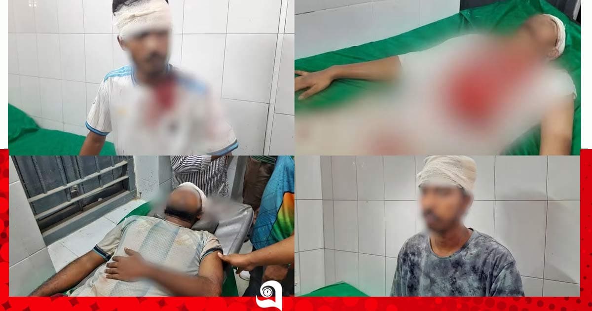 নজরুল বিশ্ববিদ্যালয়ে শিক্ষার্থীদের দু’পক্ষে সংঘর্ষ, আহত ৫