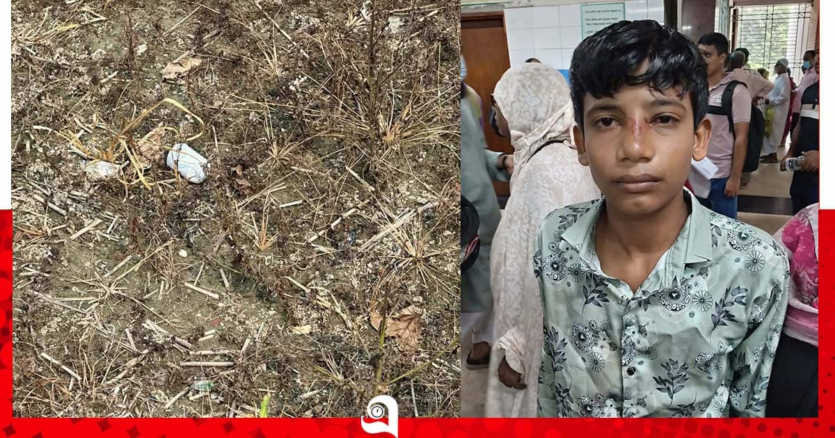 খেলনা ভেবে ককটেল হাতে নিতেই বিস্ফোরণ, কিশোর আহত