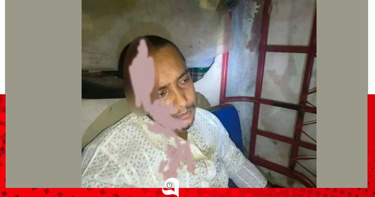 তানোরে এনসিপি নেতাকে কুপিয়ে জখম